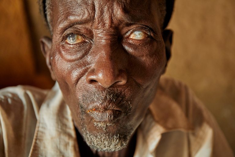 NIGERIEN ANATOMY FIGHT RIVER BLINDNESS